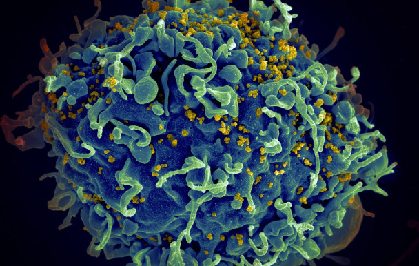 VIH: des chercheurs de l'Université de Montréal traquent le virus